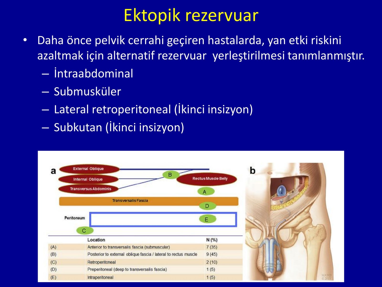 Erektil Disfonksiyon Tedavisi